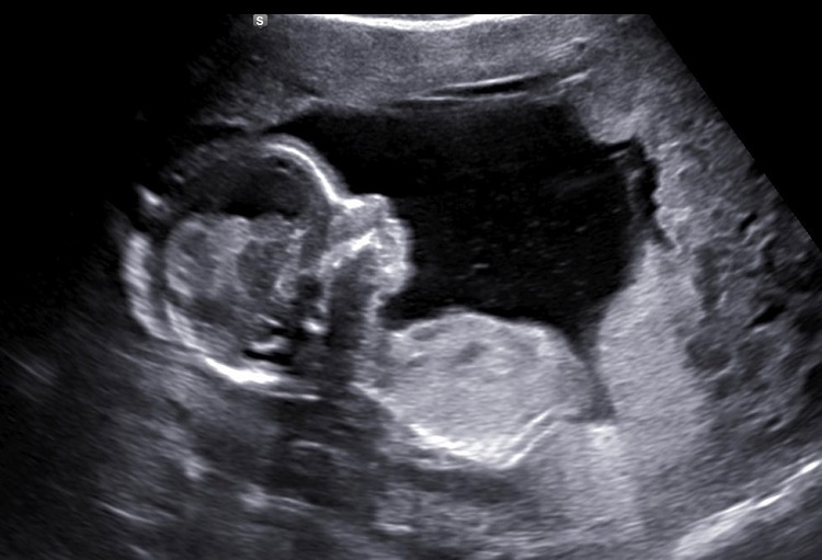 Counting On: Jessa Duggar Ultrasound
